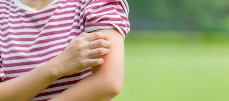 Las autoridades sanitarias nacionales pidieron intensificar las medidas de prevención contra el dengue